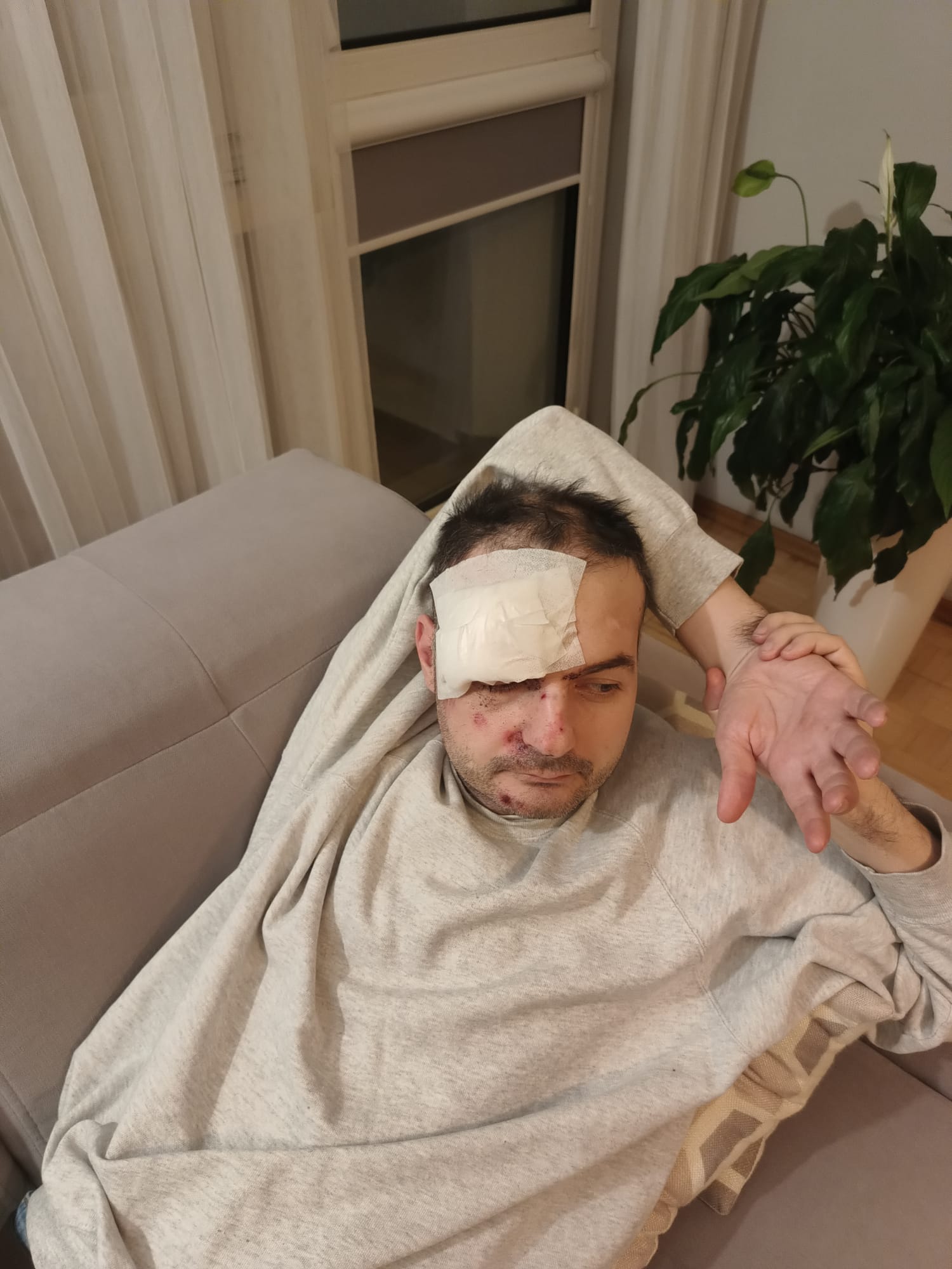 Po napadzie / post-seizure