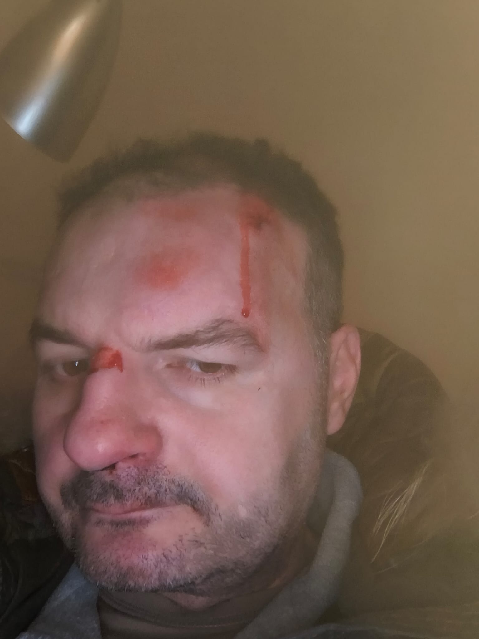 Po napadzie / post-seizure